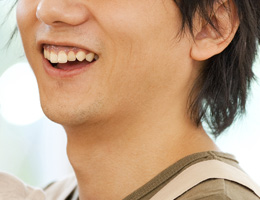 パーティー参加者の体験談S.Uさん 男性 28歳 身体障害4級・会社員
